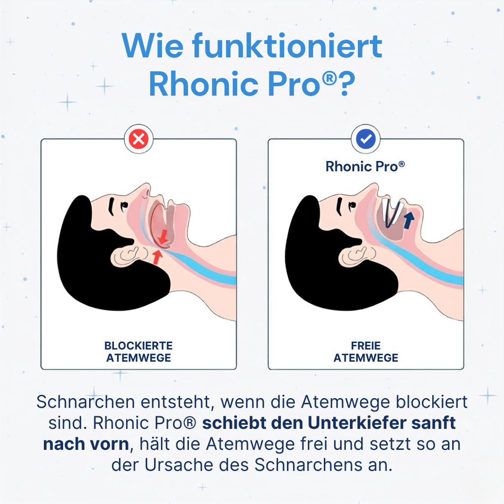 Rhonic Pro® Schnarchschiene